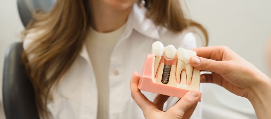Dental Patient Getting Shown A Dental Implant Model During Her Consultation in Allen, TX